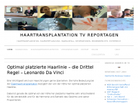 Screenshot des Blogs Haartransplantation Blog