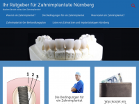 Screenshot des Blogs Zahnimplantate Info-Portal