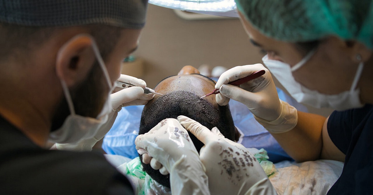 Zwei Ärzte bei einer Haartransplantation bei einem Mann